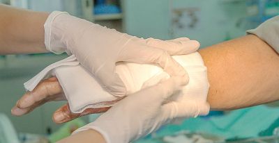 Cum să îngrijești o arsură superficială pentru a grăbi vindecarea?